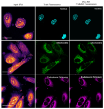 fluorescence of organelles in cancer cells