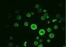 This fluorescence microscopy image shows yeast vacuoles that have undergone phase separation. Credit: Luther Davis/Alexey Merz/University of Washington