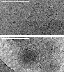 vesicles