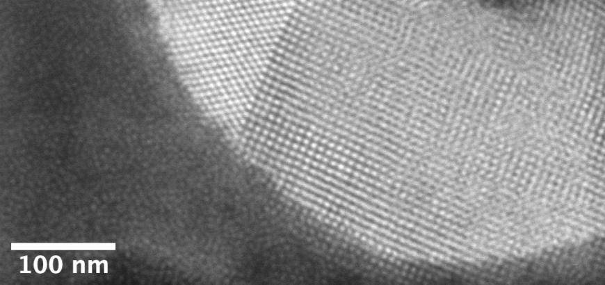 A black and white microscopy image with a scale of 100 nm in the lower left corner.